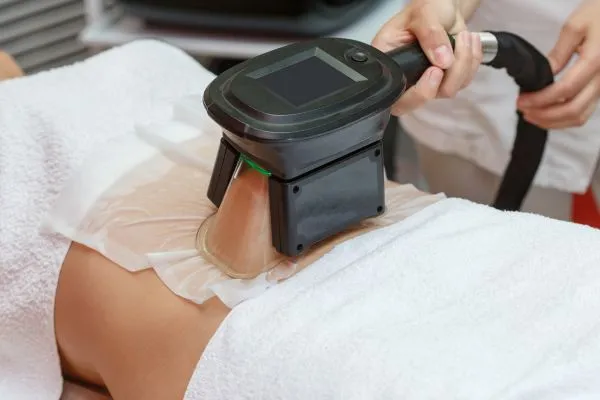 Image of person having fat freezing treatment to help weight gain Doncaster