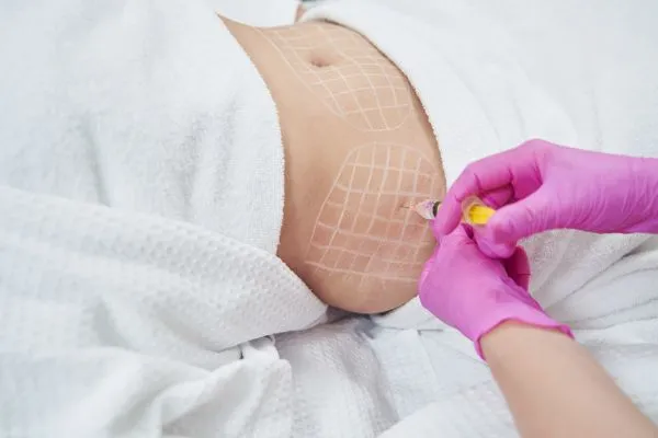 image of fat dissolving injections on love handles to help combat weight gain Doncaster