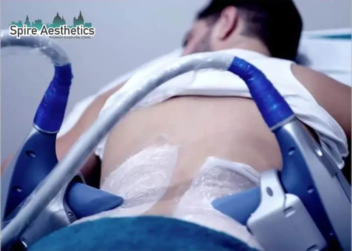 Man having fat freezing treatment done on love handles before a competitions Doncaster to create a sculpted look.
