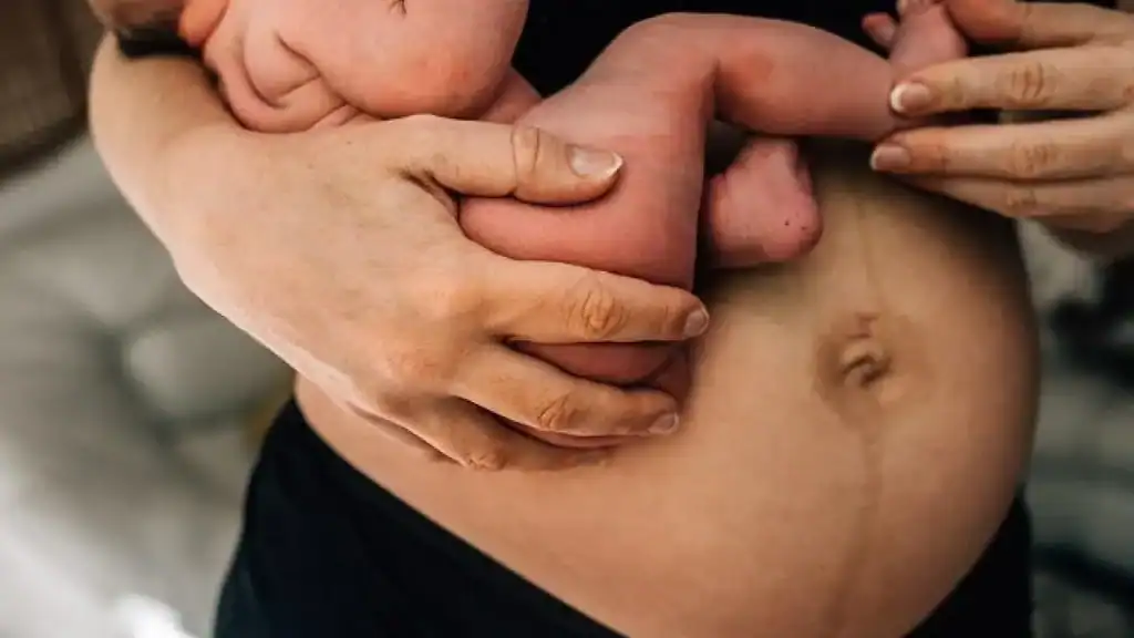 Why Is My Stomach Still Big After Pregnancy Doncaster?